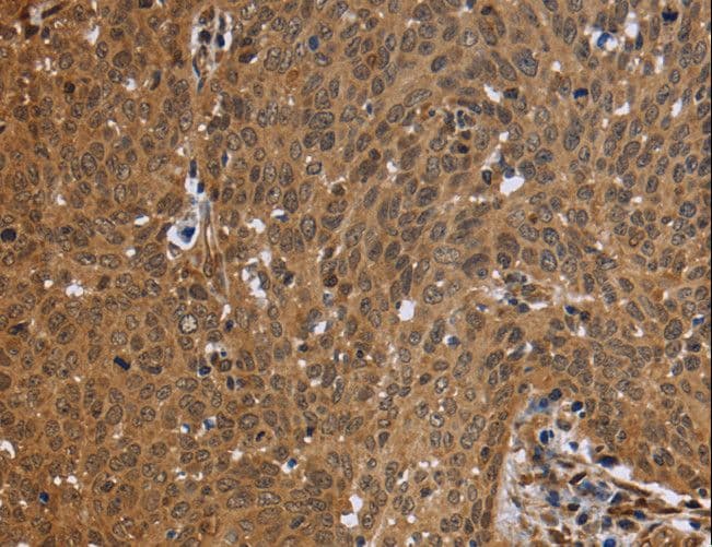Polyclonal Rabbit anti-Human FHL2 Antibody (IHC, WB)