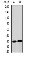 TERE1 / UBIAD1 Antibody