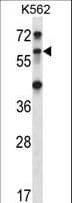 Polyclonal Rabbit anti-Human TRIM27 Antibody (aa453-482, WB)