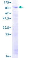 Human BTRCP / BETA-TRCP Protein (Recombinant GST)