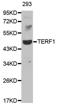 Polyclonal Rabbit anti-Human TRF1 / TERF1 Antibody (IHC, WB)
