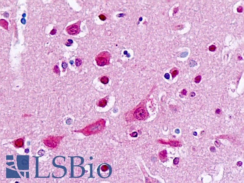 IHC-plus™ CYP2B6 Antibody (aa241-290)
