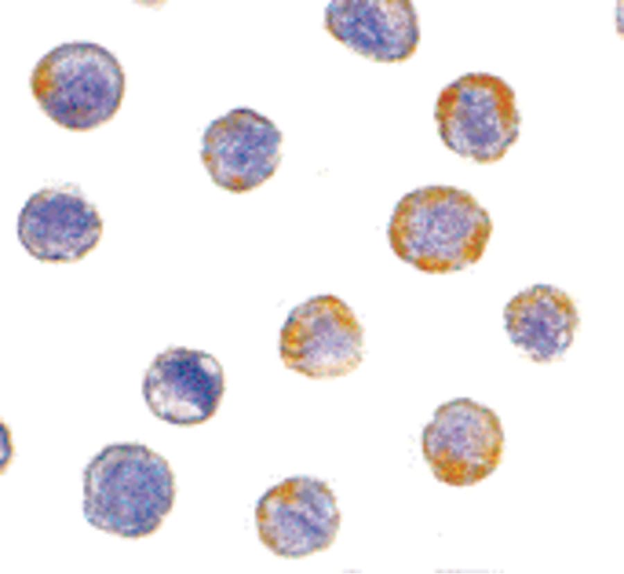 Polyclonal Rabbit anti-Human GFRA2 Antibody (WB)