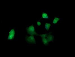 KLK8 / Kallikrein 8 Antibody (clone OTI1A9)