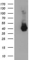 MAGEB18 Antibody (clone OTI6A5)