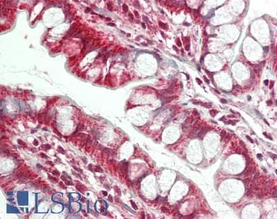 IHC-plus™ CSNK2B / Phosvitin Antibody (aa100-150)