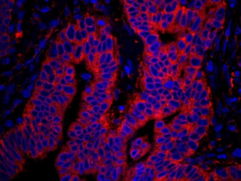 IHC-plus™ RPL7A / Ribosomal Protein L7a Antibody (aa215-C-term)