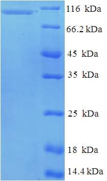 Human GNL2 Protein (Recombinant His-SUMO)