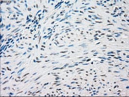 SSB / La Antibody (clone OTI3H9)