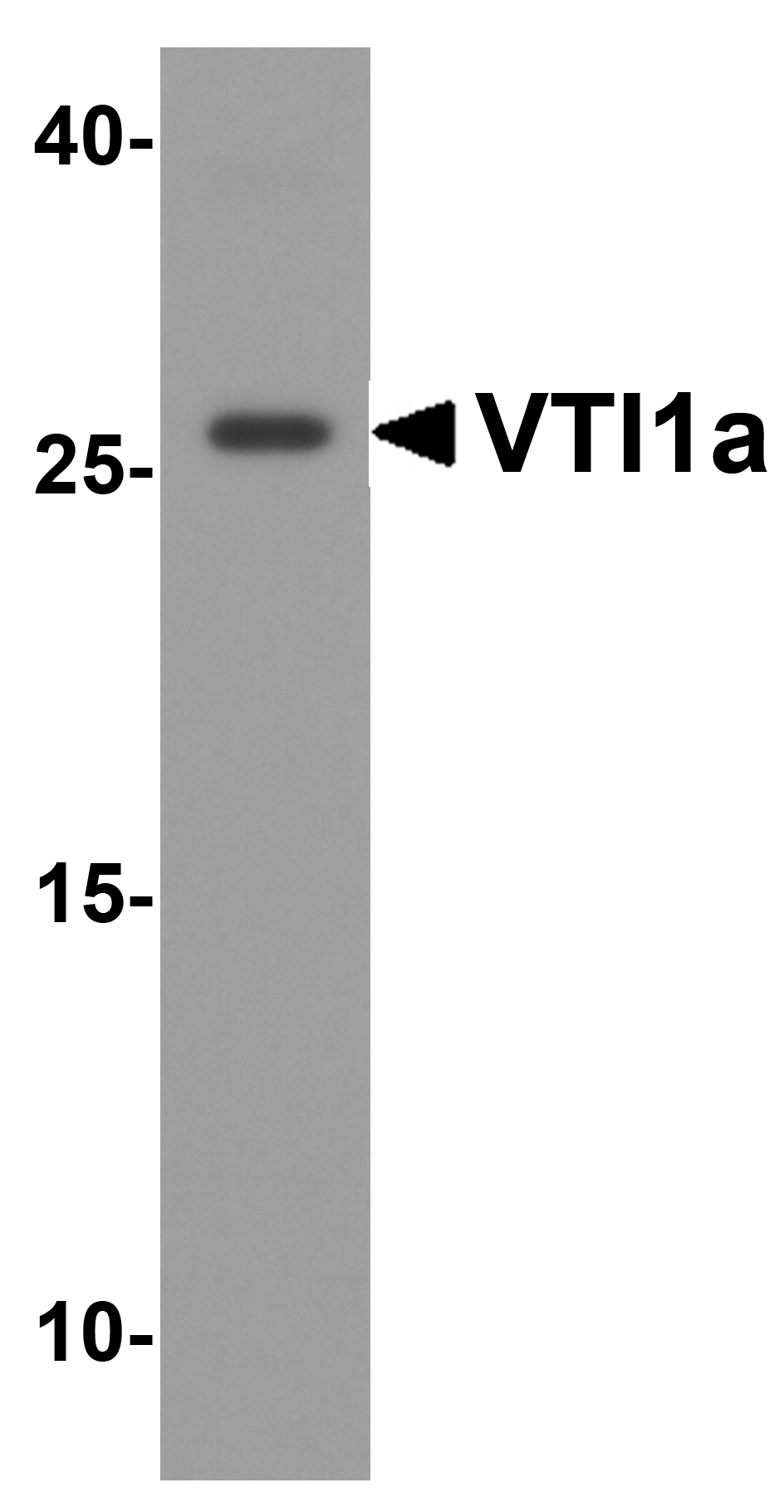 IHC-plus™ Polyclonal Rabbit anti-Human VTI1A Antibody (IHC, WB)