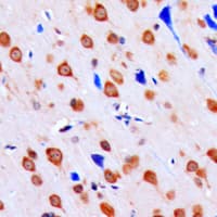 Polyclonal Rabbit anti-Human CHEK1 / CHK1 Antibody (phospho-Ser317, IHC, WB)
