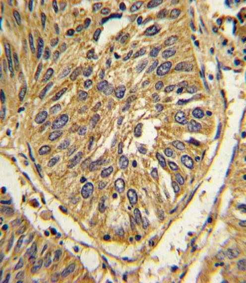 FGFR2 / FGF Receptor 2 Antibody