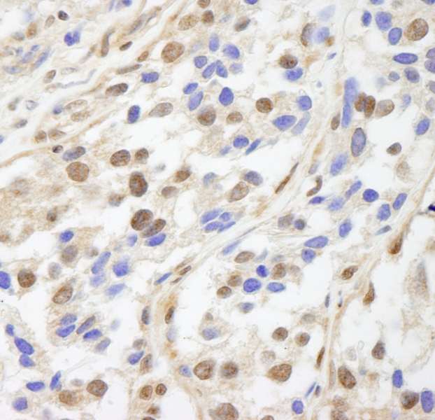 Polyclonal Rabbit anti-Human UACA Antibody (aa675-725, IHC)