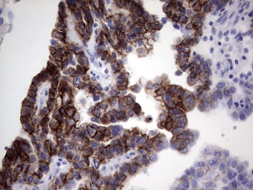 KRT19 / CK19 / Cytokeratin 19 Antibody (aa240-390, clone OTI1A8)