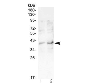 CCR5 Antibody