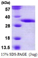 Human DECR2 Protein (Recombinant His)
