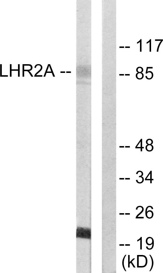 VWA5A Antibody (aa371-420)