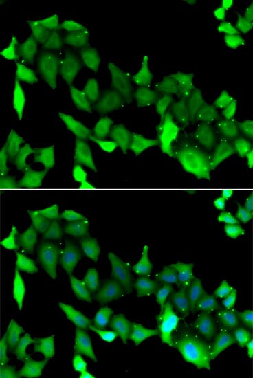 GRK6 Antibody