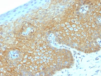 Recombinant Monoclonal Rabbit anti-Human CTNNB1 / Beta Catenin Antibody (clone CTNNB1/2030R, Azide-free,Carrier-free, IHC, IF, WB)