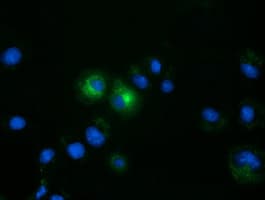 FSHB / FSH Beta Antibody (clone OTI2A6)