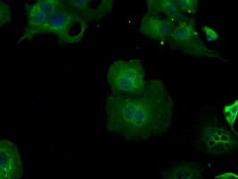 BHMT Antibody (clone OTI10B3)