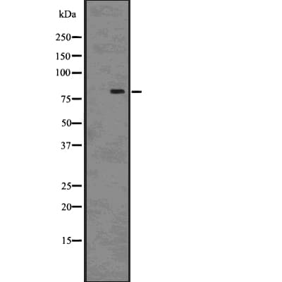 Polyclonal Rabbit anti-Human SATB2 Antibody (IHC, IF, WB)