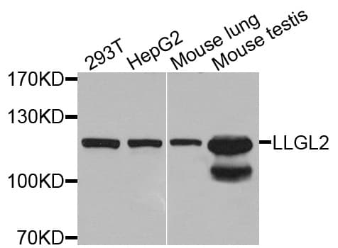 LLGL2 Antibody