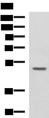 GALK2 Antibody