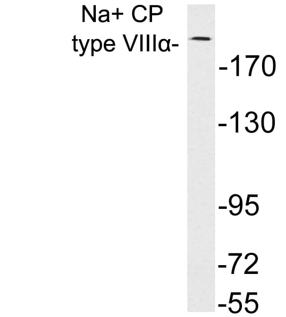 SCN8A / Nav1.6 Antibody (aa1313-1362)