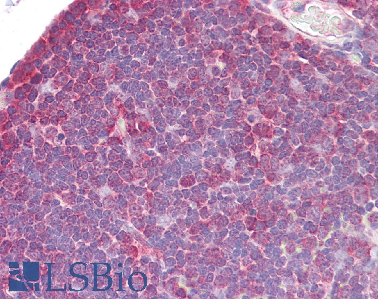 IHC-plus™ Polyclonal Rabbit anti-Human ZAP70 Antibody (aa460-509, IHC)