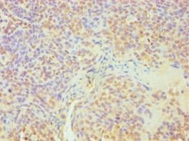 Polyclonal Rabbit anti-Human DDX5 Antibody (aa1-290, IHC, WB)