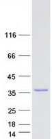 Human DOHH Protein (Recombinant Myc-DDK (Flag))