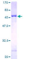 Human NR2E3 / PNR Protein (Recombinant GST)