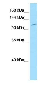 ADGRL1 / LPHN1 Antibody (aa1252-1301)