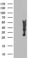 Monoclonal Mouse anti-Human MLF2 Antibody (clone OTI1E12, WB)