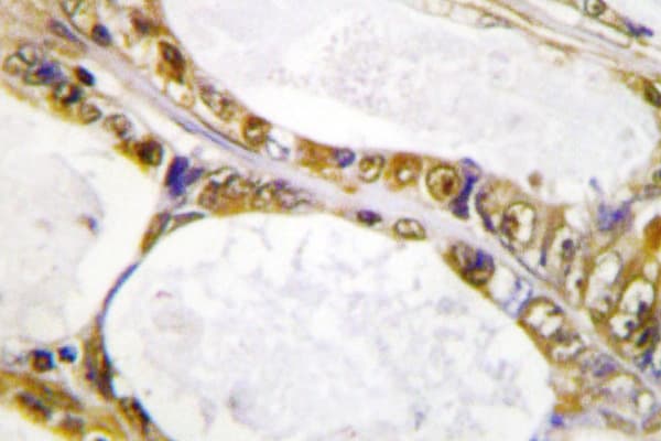IRF2 Antibody (Lys129)