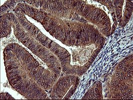 MAP2K1 / MKK1 / MEK1 Antibody (clone OTI5D3)