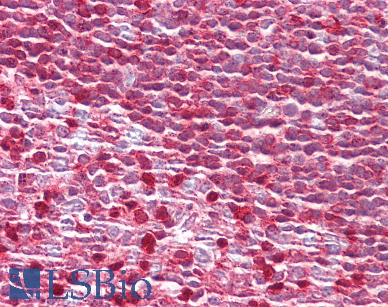 PathPlus™ Polyclonal Rabbit anti-Human MTOR Antibody (aa2415-2464, IHC, WB)