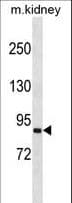 Polyclonal Rabbit anti-Human SEMA4A / Semaphorin 4A Antibody (aa151-180, WB)