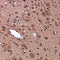 UAP1 Antibody