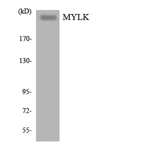 Polyclonal Rabbit anti-Human MYLK Antibody (aa1691-1740, WB)