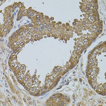 Polyclonal Rabbit anti-Human CHRFAM7A Antibody (IHC, WB)