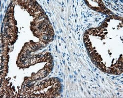 Monoclonal Mouse anti-Human L1CAM Antibody (clone OTI2H5, IHC, IF, WB)