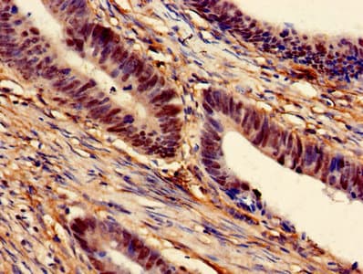 Polyclonal Rabbit anti-Human MAT2A Antibody (IHC)