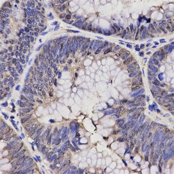 NPPA / ANP Antibody