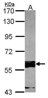 Polyclonal Rabbit anti-Human FASTK / FAST Antibody (aa346-549, IHC, WB)