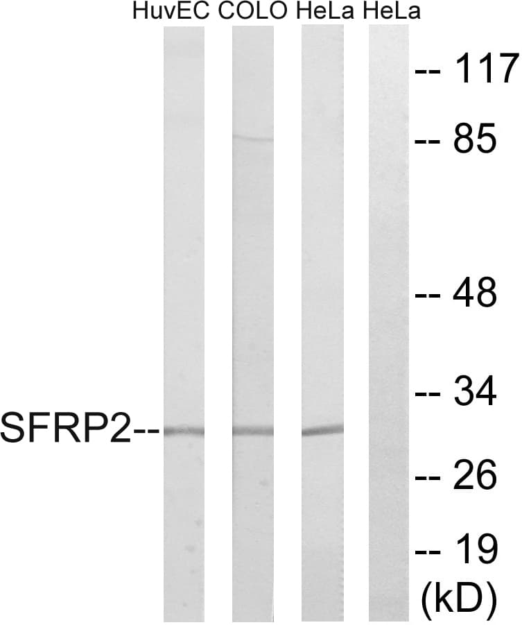 Polyclonal Rabbit anti-Human SFRP2 Antibody (aa119-168, WB)