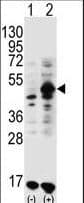 GDF9 / GDF-9 Antibody (aa30-59)