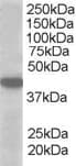 IHC-plus™ SLC16A7 / MCT2 Antibody (aa465-478)