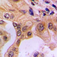 Polyclonal Rabbit anti-Human RELA / NFKB p65 Antibody (phospho-Ser529, IHC, WB)